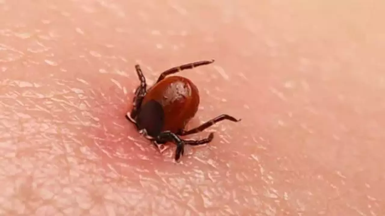 Kene Isirigi Durumunda Ne Yapmaliyiz Keneden Korunma Yollari Nelerdir 1749638269 1049