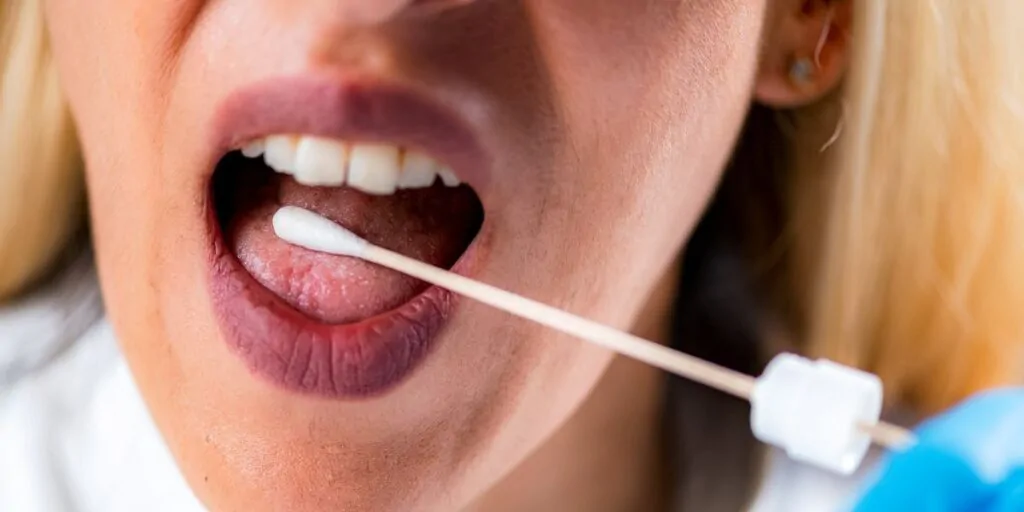 Agiz Kokusuna Neden Olabilecek 7 Gida 2 1024X512