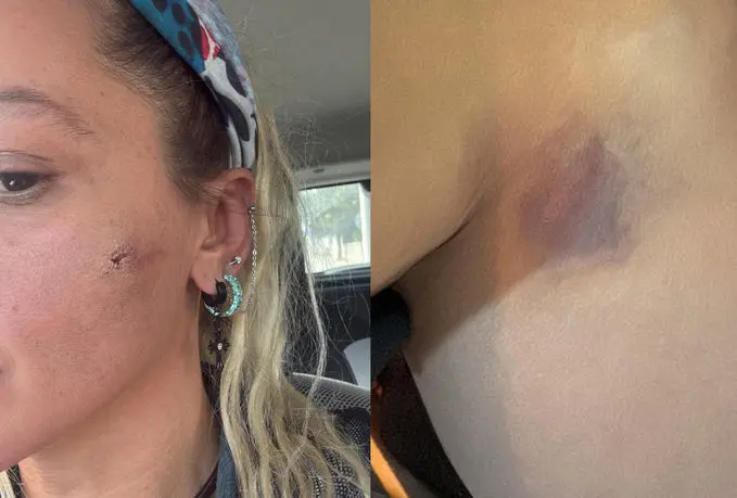 3843968 E4Ebdbf40014818C9028156Af2Aca592.Jpg