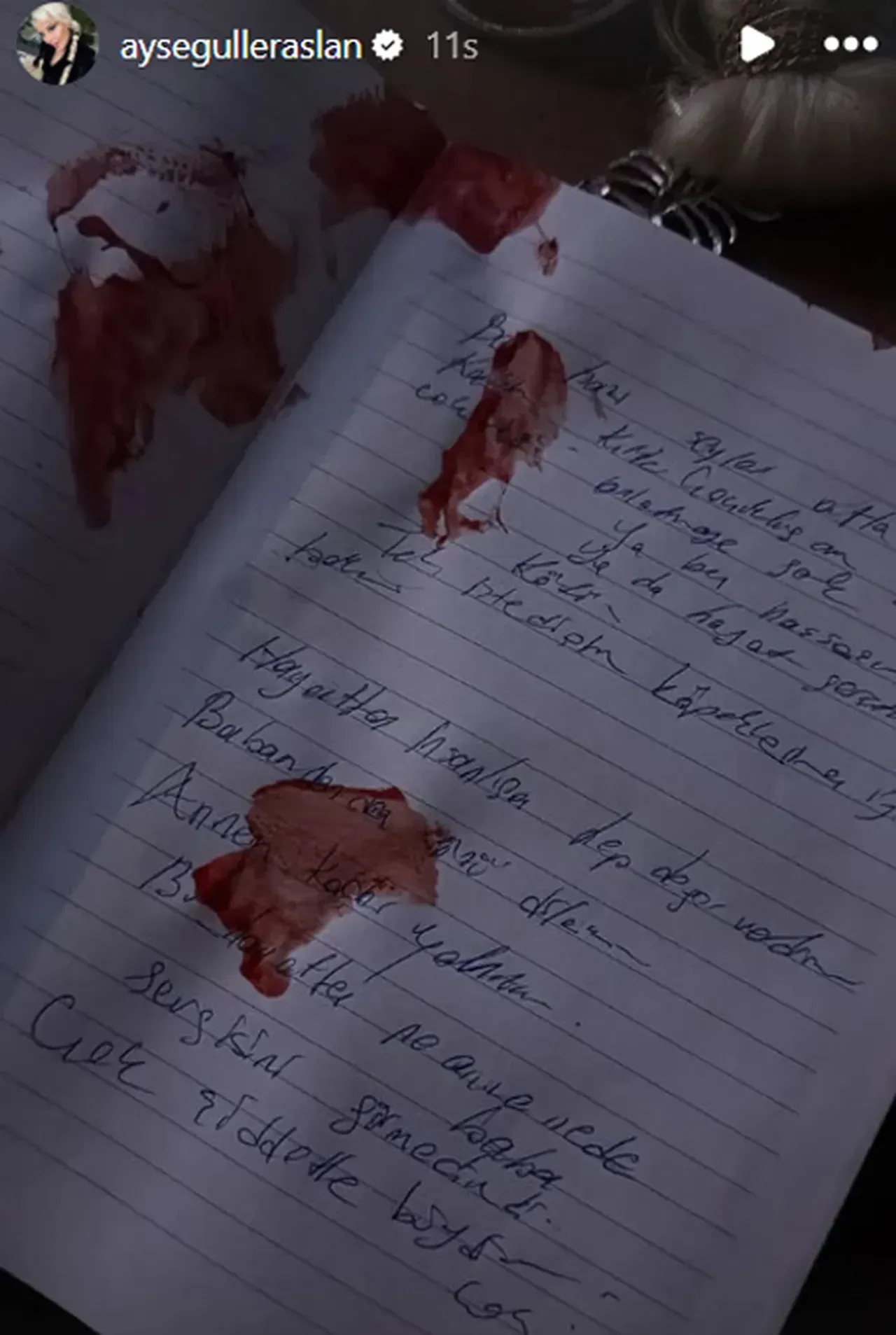 Intihar Degil Cinayet Aysegul Eraslanin Otopsi Raporundaki Gercek Ortaya Cikti 1777035 202603140951 20260314095129 3