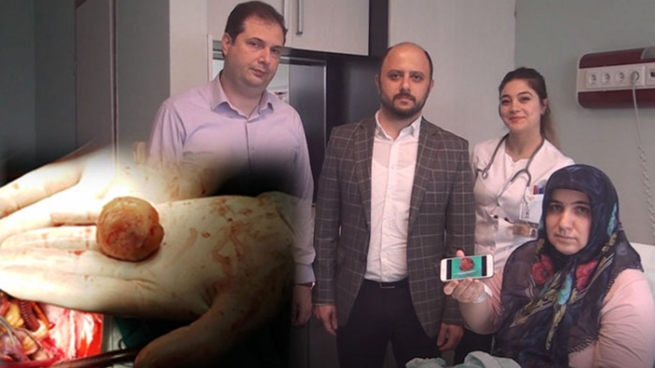 Kahramanmaraş'ta kalbinden 6 santimetrelik kitle çıkartıldı