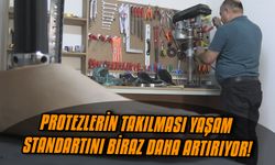Protezlerin takılması yaşam standartını biraz daha artırıyor!