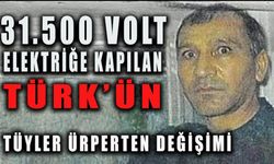 31.500 Volt Elektriğe Kapılan Türk’ün Tüyler Ürperten Değişimi