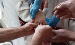 Elbistan‘da yaşlı kadının sıkışan yüzüğü kesilerek çıkarıldı