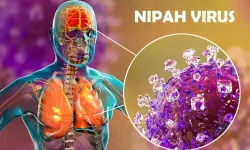 Nipah Virüsü Nedir, Nasıl Ortaya Çıktı, Belirtileri Nelerdir, Aşı ve Tedavisi Var mı?