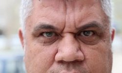 Doğuştan gelen farklı göz renkleriyle dikkat çekiyor