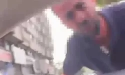 Otoparkçılar tarafından saldırıya uğradı
