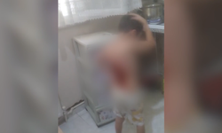 Akran Zorbalığı Dehşete Dönüştü! 12 Yaşındaki Çocuğun Sırtına Kolonya Döküp Yaktılar