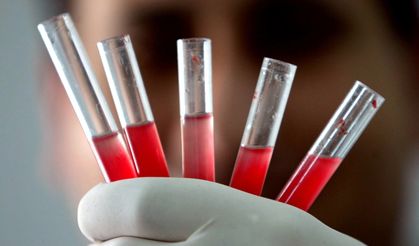 Yeni Kan Grubu Keşfedildi! Ne Kan Verebiliyor Ne de Alabiliyor!