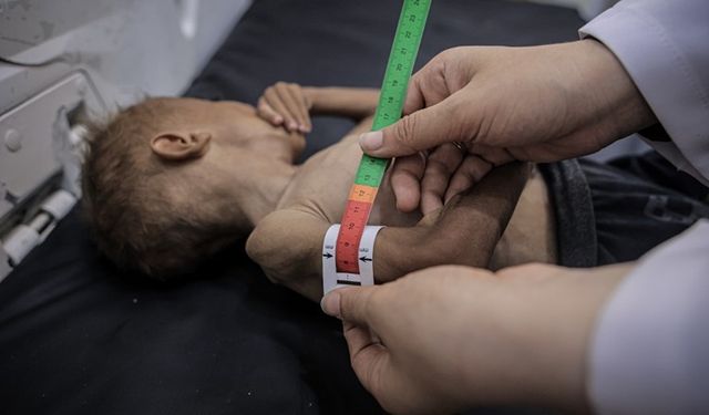 Ambargo nedeniyle 376 kişi açlıktan hayatını kaybetti