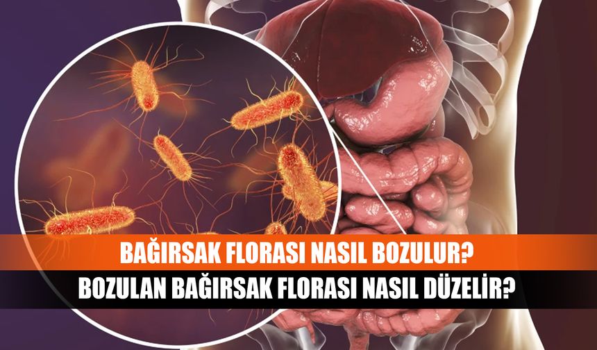 Bağırsak florası nasıl bozulur? Bozulan bağırsak florası nasıl düzelir?