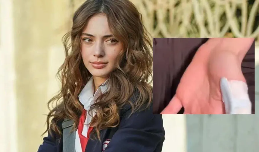 Teşkilat Setinde Korkutan Kaza: Rabia Soytürk Hastaneye Kaldırıldı