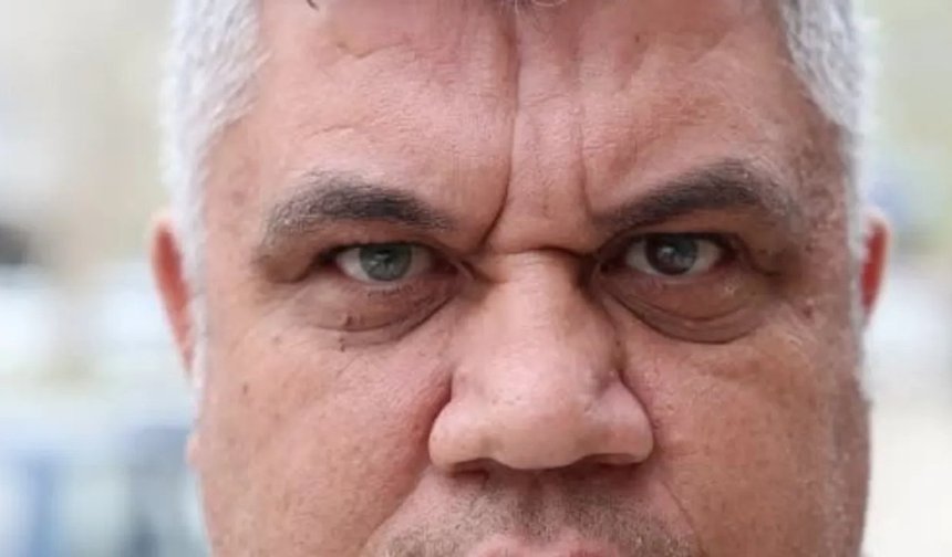 Doğuştan gelen farklı göz renkleriyle dikkat çekiyor